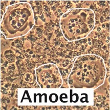 Amoeba cause bleeding gums