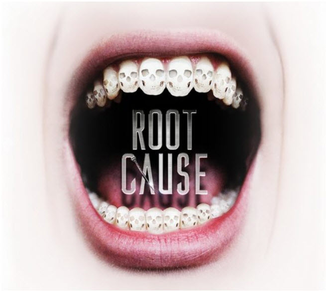 Is The “Root Cause” Movie Right About Root Canals?