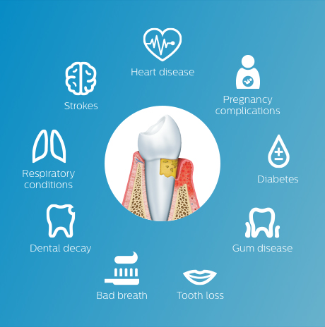 The Mouth as a Barrier System